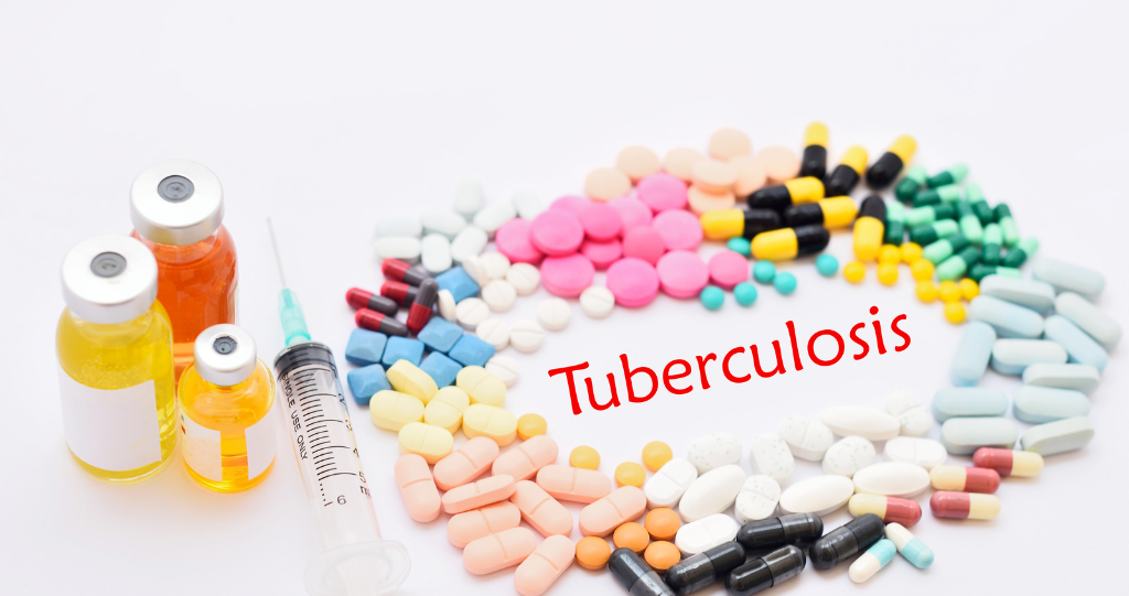 Understanding Tuberculosis: Causes, Treatment & Prevention Methods